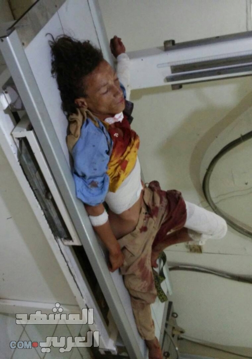 إصابة 3 أطفال بقذائف مليشيات الحوثي غرب مريس