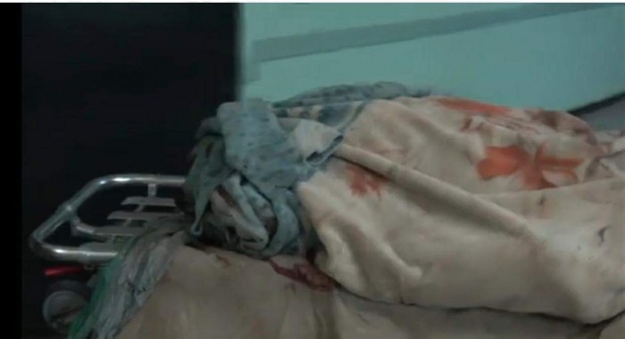 استشهاد مواطن وإصابة أخر في انفجار عبوة ناسفة حوثية بالحديدة (فيديو)