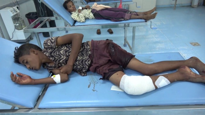 إصابة طفلين برصاص مليشيا الحوثي في حيس (فيديو)