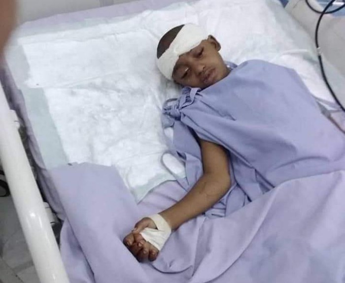 ضحية القناص الحوثي.. استخراج رصاصة من رأس الطفلة رويدا بتعز